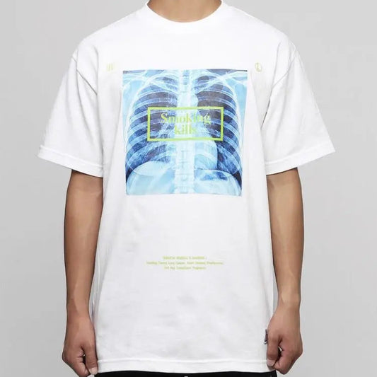 FR2 Fxxkingrabbits X-Ray Smoking Kills Tee White