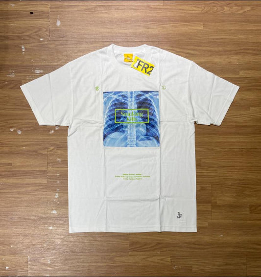 FR2 Fxxkingrabbits X-Ray Smoking Kills Tee White