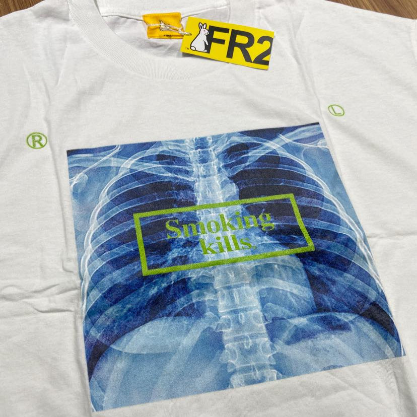 FR2 Fxxkingrabbits X-Ray Smoking Kills Tee White